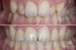 Orthodontie orthodontics ortodontia Casos Clínicos