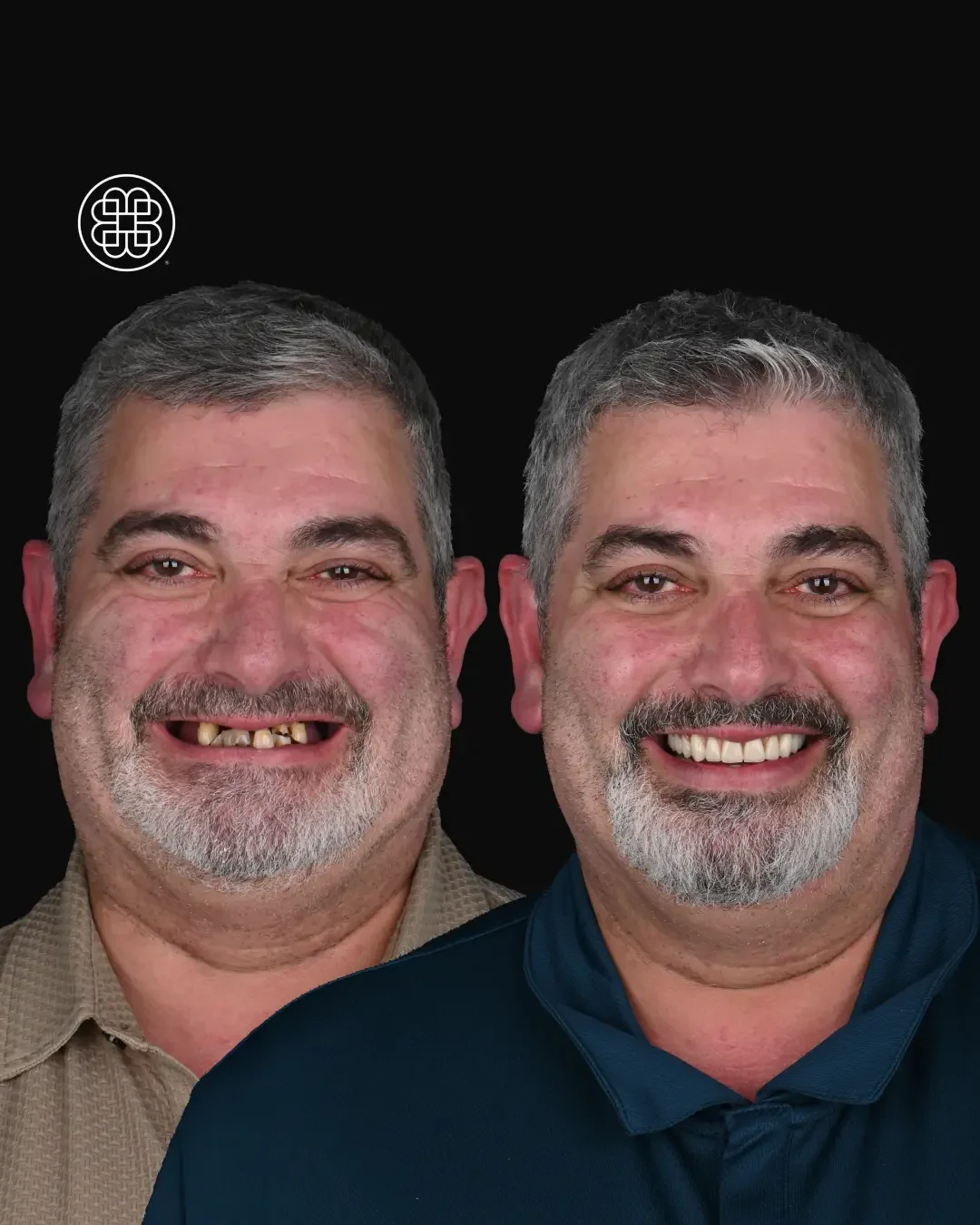 Carlos da Silva 1.2