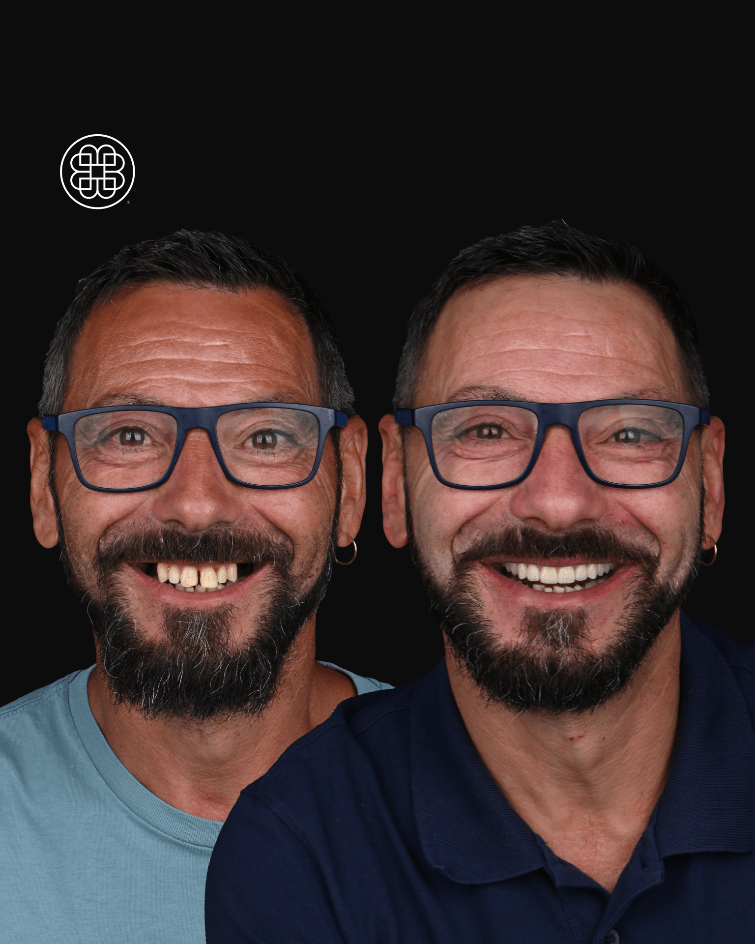 AO4 Luxembourg - Bouche Dental Group AV