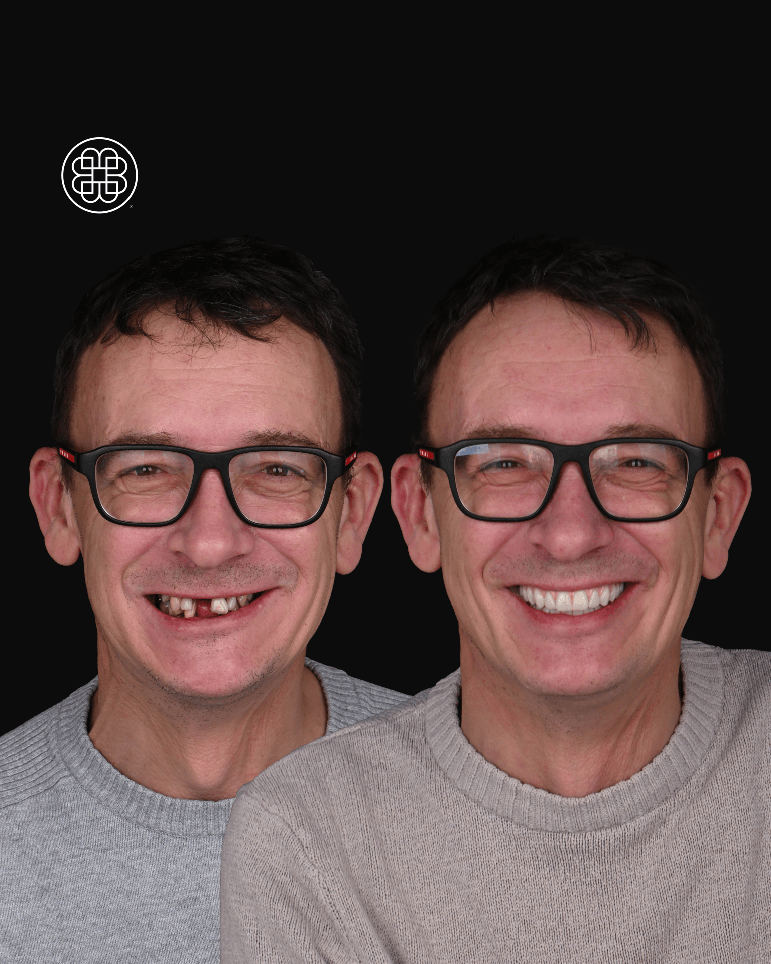 AO4 Luxembourg - Bouche Dental Group DS