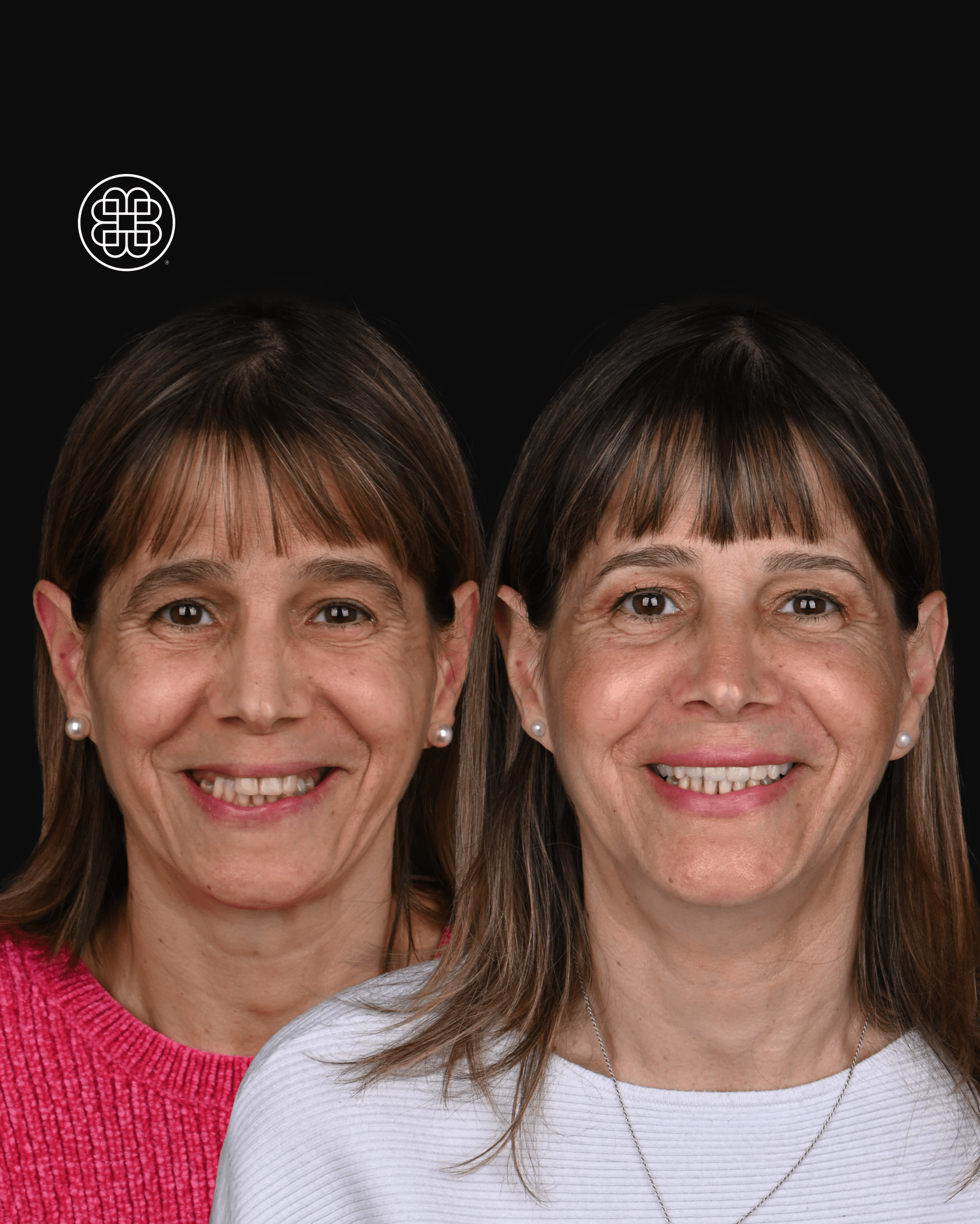 AO4 Luxembourg - Bouche Dental Group F (3)