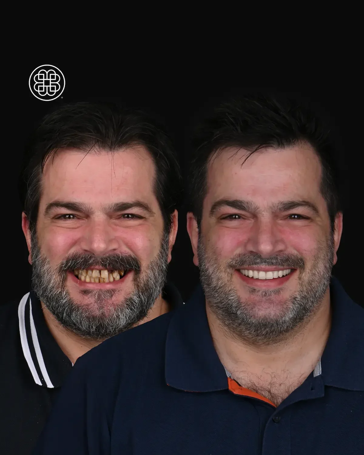 AO4 Luxembourg - Bouche Dental Group H