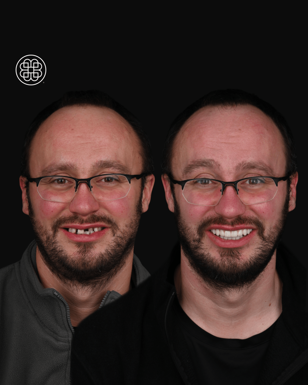AO4 Luxembourg - Bouche Dental Group J