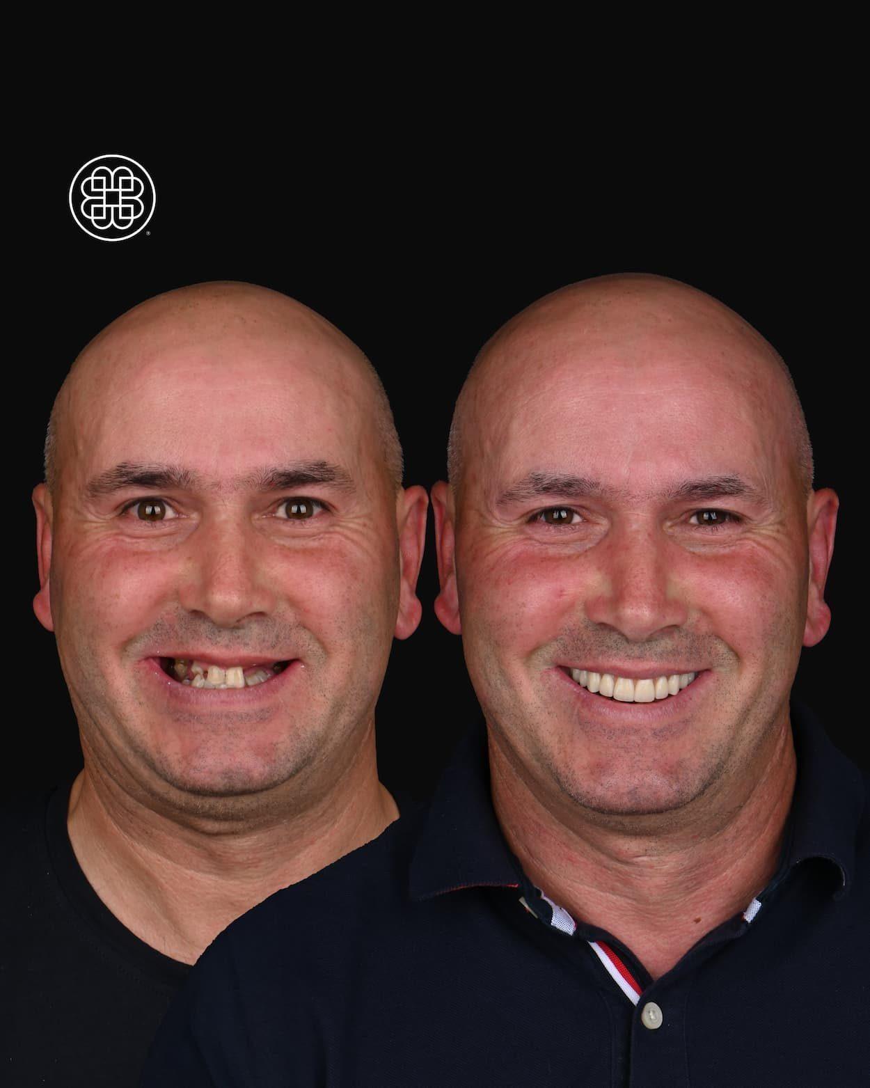 AO4 Luxembourg - Bouche Dental Group JA