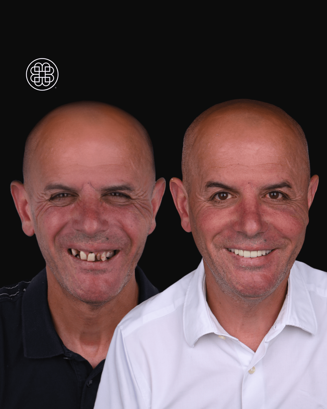 AO4 Luxembourg - Bouche Dental Group MC-1