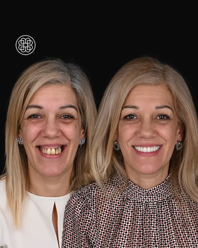 AO4 Luxembourg Bouche Dental Group MM A1