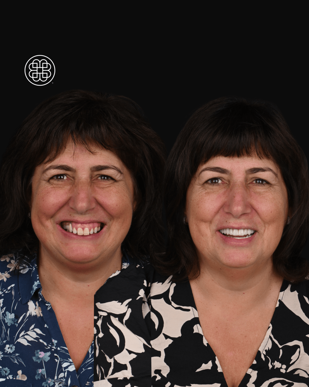 AO4 Luxembourg - Bouche Dental Group RC