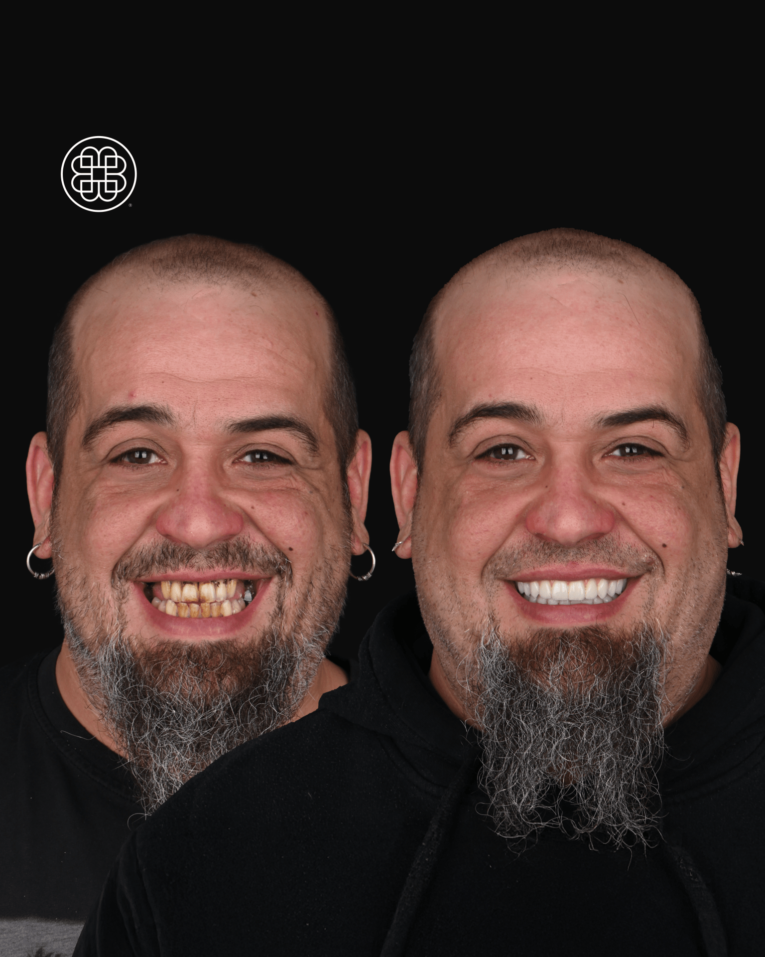 AO4 Luxembourg - Bouche Dental Group fe