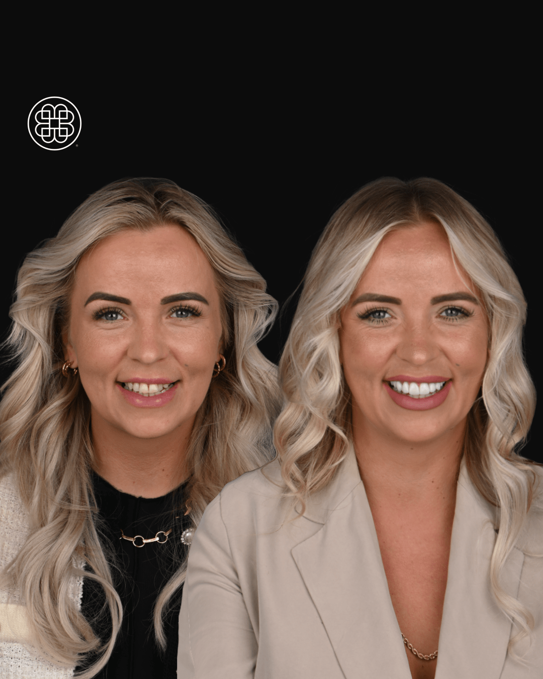 Veneers Luxembourg - Bouche Dental Group