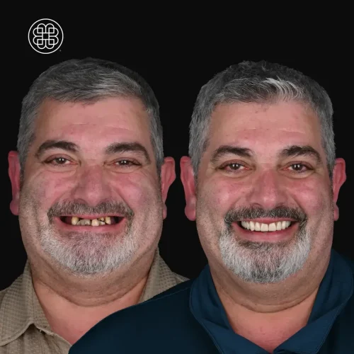 Carlos da Silva 1.2