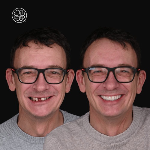 AO4 Luxembourg - Bouche Dental Group DS
