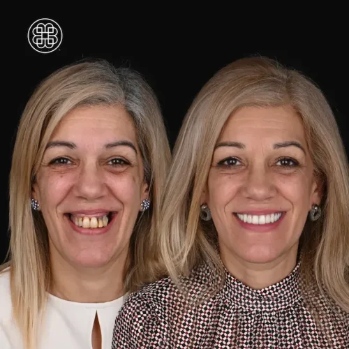 AO4 Luxembourg Bouche Dental Group MM A1