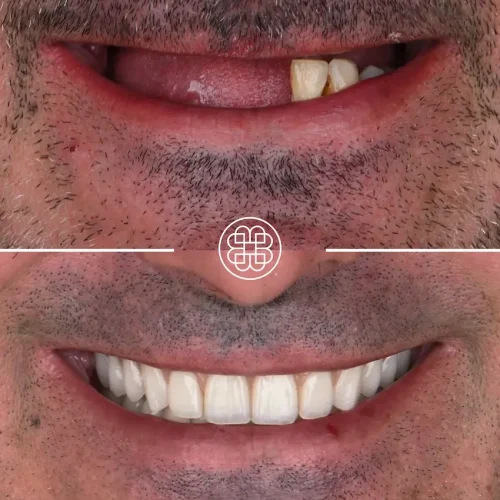 AO4 Luxembourg - Bouche Dental Group