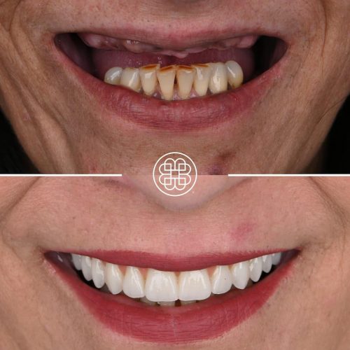AO4 Luxembourg - Bouche Dental Group